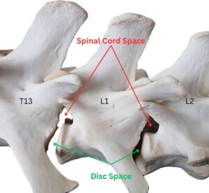 Lateral view of T13, L1 and L2 of a dog's vertebrae